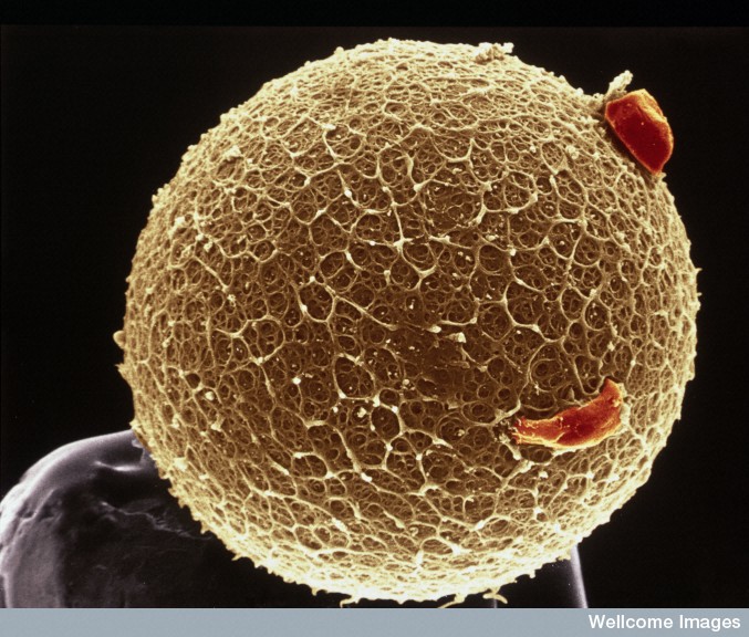 This microscopic image of a human egg is sitting on the point of a pin.   Credit: Wellcome Images via Flickr 